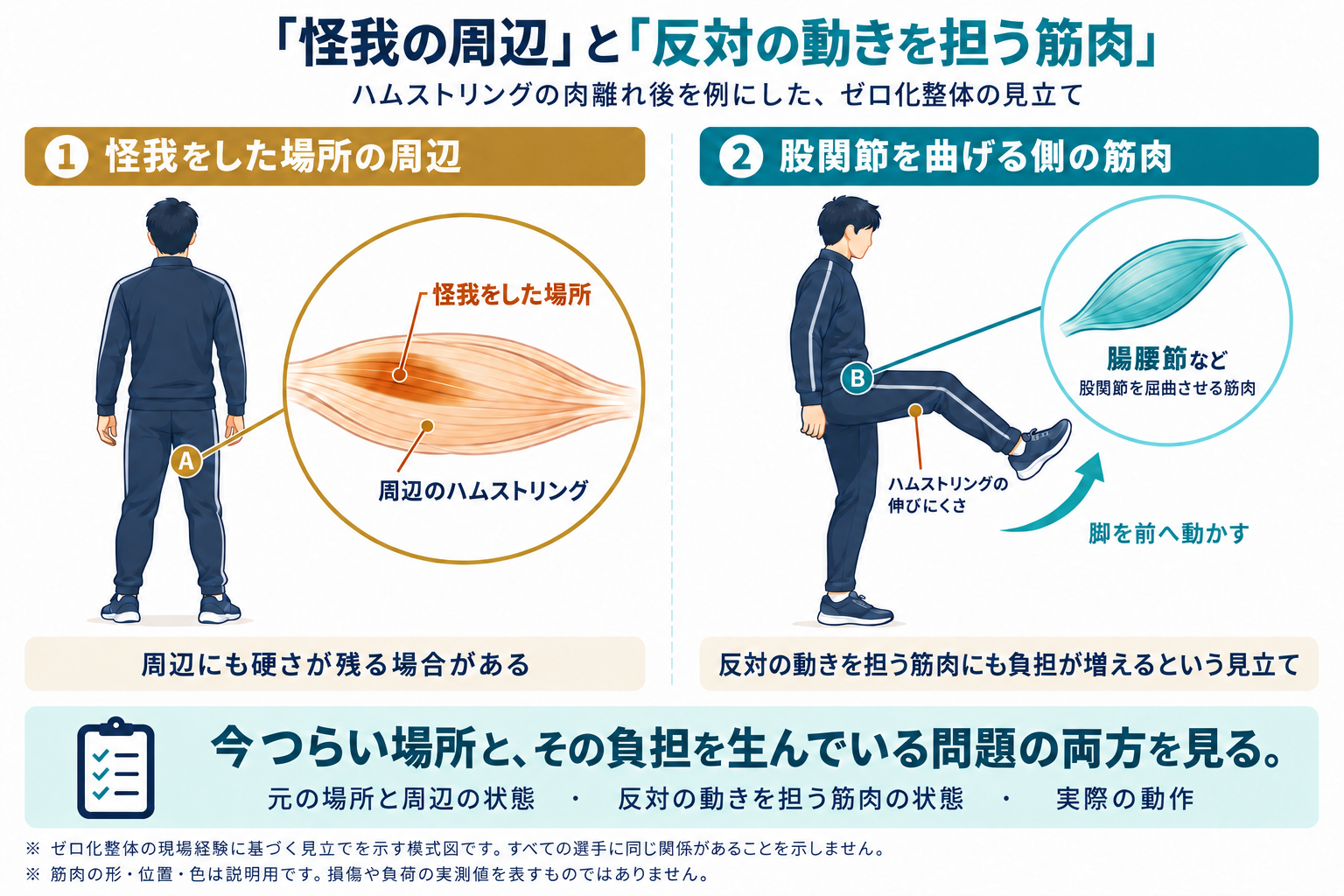 ハムストリングの怪我をした場所の周辺と、同じ側で股関節を曲げる筋肉の関係